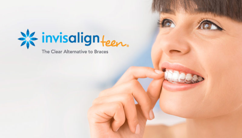 Invisalign for teens